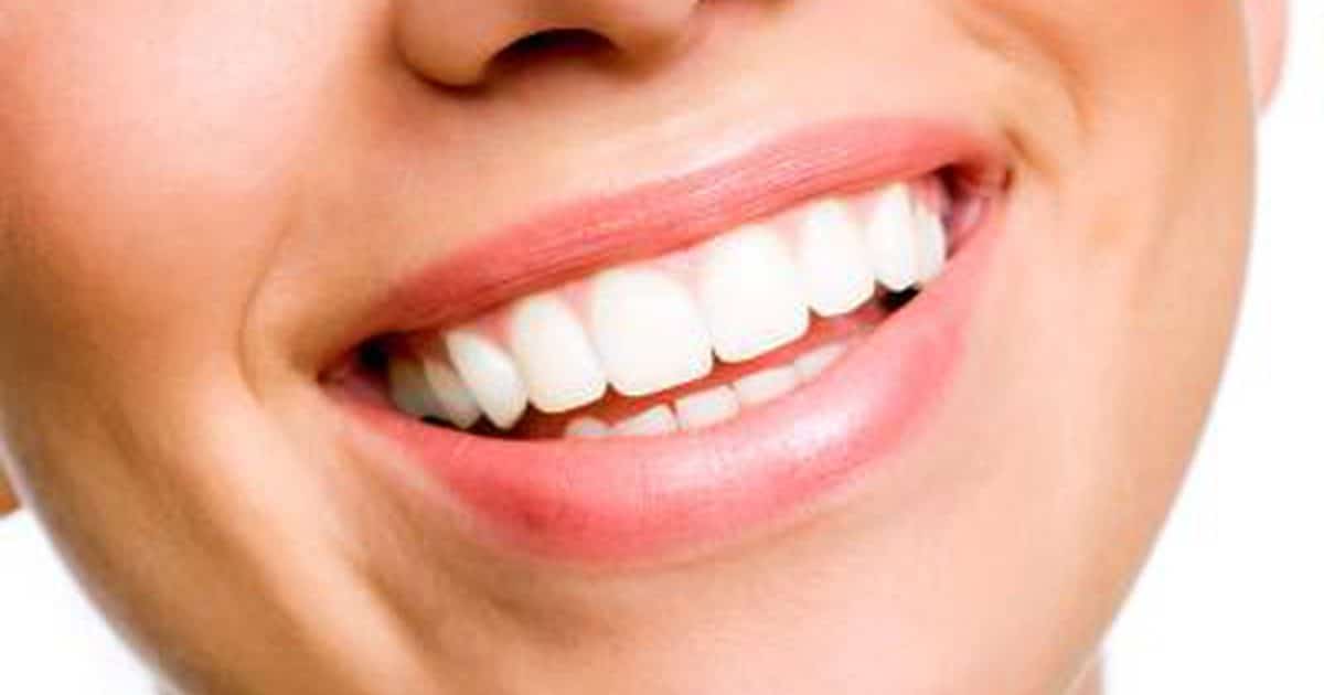 4 Natural Tips For an Extremely White Teeth. • Free Samples Australia